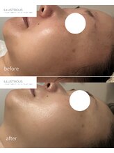 サンラックスサロン 岐阜(SANlux Salon)&nbsp;人気 No.2