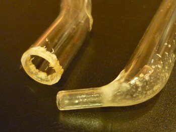 トータルビューティーサロン エレガントリゾート/毛穴フェイシャルコース