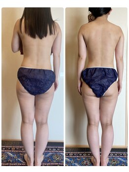 ローズ 下松(ROSE)/【筋膜リリース120分】