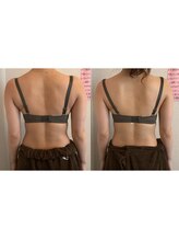 カリス(CHARIS)/背中をスッキリさせる