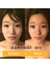 【撮影モニター】頭蓋骨小顔矯正+整顔+首肩オイルリンパ（60分）　13000円⇒
