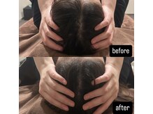 サルース(Salus)の雰囲気（【目黒駅から徒歩7分】完全プライベート空間◎【美容鍼/美容】）