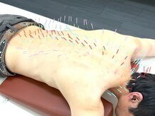 とだ鍼灸院の雰囲気（【首肩/背中/腰の筋膜のコリ！】ストレス頭痛/疲れた体が楽に◎）