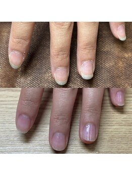 リリ(lili)/ハンドトータルケア/ネイルケア