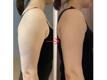 ラシュシュ モイ(moi)