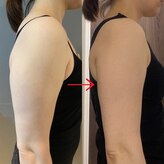 ラシュシュ モイ(moi)