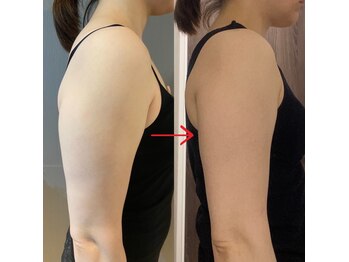 ラシュシュ モイ(moi)