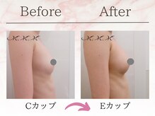 エムエムエム 表参道Luxeサロン(M.M.M)/【バストアップ例】　C→Eカップ