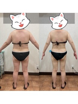 リンパサロン リ スタート/マグニートダイエット