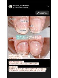 美爪育成ケア＋補強コーティング