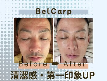 ベルカルポ(Bel Carp)