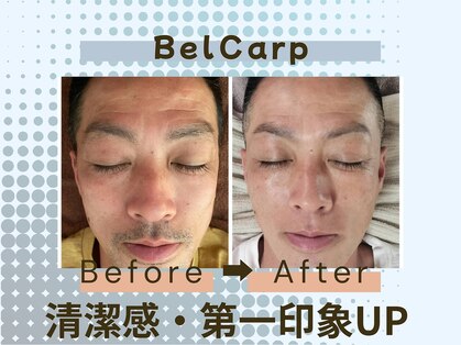 ベルカルポ(Bel Carp)の写真