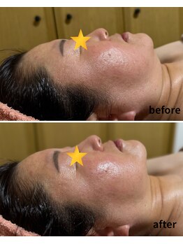 ソフィアアイズ 倉敷店(SOPHIAEYES)/ハイパーナイフ＆レモンボトル