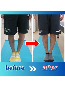 ストレッチヒーロー 倉吉店(STRETCH HERO)/O脚、X脚