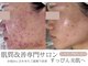 プシュケ(Psyche)の写真