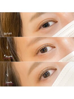 イチマルイチ(&101)/ラッシュリフト