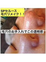肌屋(HADA-YA)/SPセルース＋毛穴リメイク