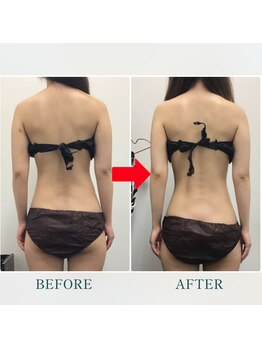 ステイゴールド美容整体院(STAY GOLD)/肩甲骨整体とハイパーナイフ効果