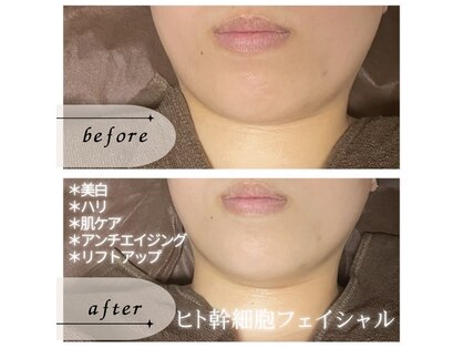 コマチ(comachi)の写真