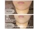 コマチ(comachi)の写真