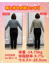 はぴねす整骨院/50代女性