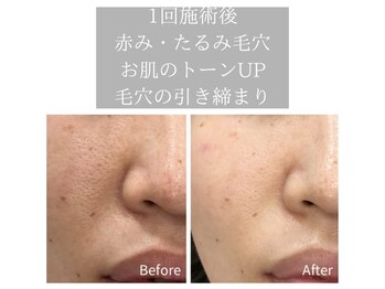 ルチア(Lucia di Piu Felice)/