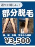 【選べて嬉しい!】まずは見えるところから整える! 部分脱毛 ¥3,500