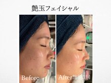 アンドミルル(and Milulu)/【韓国艶玉フェイシャル】