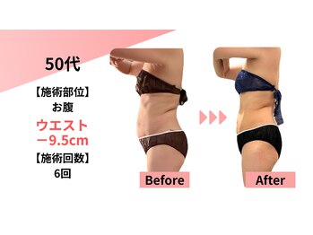 クレビア(Clevia)/Clevia-クレビア