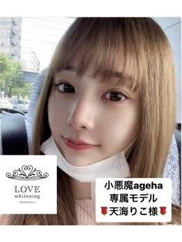 ラブホワイトニング 渋谷店(LOVEホワイトニング)/ラブホワイトニング