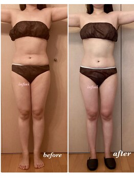 アンフィニ(infini)/短期集中コース6回(2ヶ月)