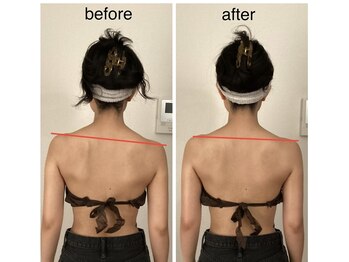 リラココ(リラcoco)/ビフォーアフター(20代お客様)