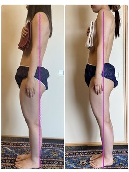 ローズ 下松(ROSE)/【筋膜リリース90分リピーター】