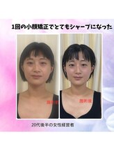 ハナノ整体院/童顔になった