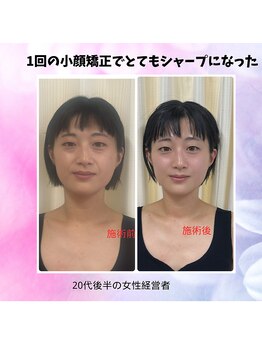 ハナノ整体院/童顔になった