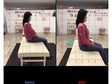 ストレチックス 近江八幡店/BeforeAfter