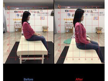 ストレチックス 近江八幡店/BeforeAfter