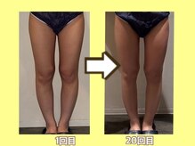 ビオール 池袋店(beall)/大人気！痩身オーダーメイド90分