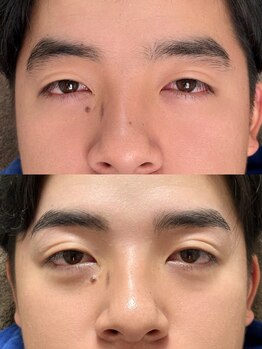 メンズにオススメのサロン