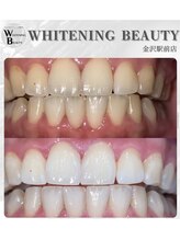 ホワイトニングビューティー 金沢駅前店(WHITENING BEAUTY)/短期間で真っ白に！