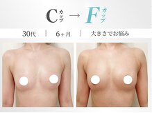 美人バスト 小倉店の雰囲気(【育ちづらい原因を徹底解明】育乳のプロがバストアップを実現!)