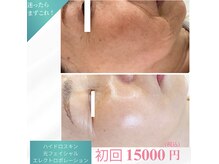 プリエ(Prier)の雰囲気(最新光フェイシャルでシミは取れる時代へ!)