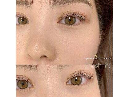 リベルテ(liberte)の写真