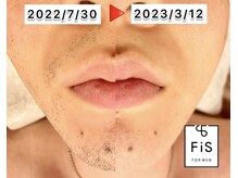 フィズ 光市店(FIS)の雰囲気（脱毛で清潔感UP！女性スタッフ在籍♪[和光市/顔脱毛/メンズ脱毛]）