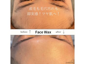 リル(Lill)の写真/お顔全体のフェイスワックスで憧れの肌へ！ツルスベ肌でリピーター続出の魅力♪