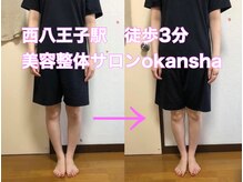 美容整体サロン オオカンシャ(okansha)/O脚矯正後☆