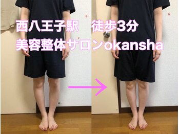 美容整体サロン オオカンシャ(okansha)/O脚矯正後☆