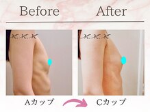エムエムエム 表参道Luxeサロン(M.M.M)/【バストアップ例】　A→Cカップ