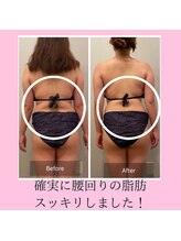 ヨサパーク ミュゲ(YOSA PARK Muguet)/痩身/ダイエット/リンパ/産後