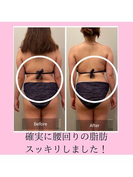 ヨサパーク ミュゲ(YOSA PARK Muguet)/痩身/ダイエット/リンパ/産後